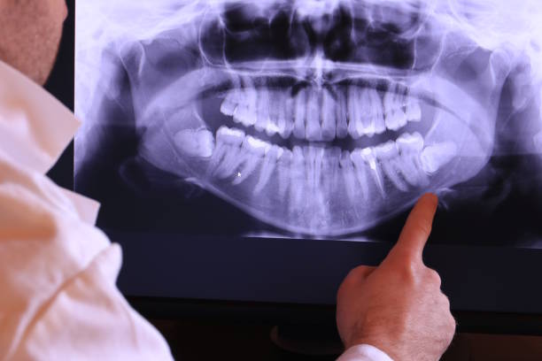 Best Emergency Gum Pain Relief  in Post, TX